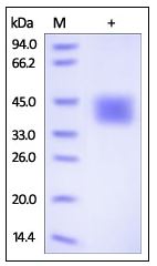Human CD84, His Tag on SDS-PAGE under reducing (R) condition. The gel was stained overnight with Coomassie Blue. The purity of the protein is greater than 95%.